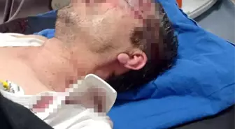 Sivas Ziraat Odası Sekreteri'ne saldırı