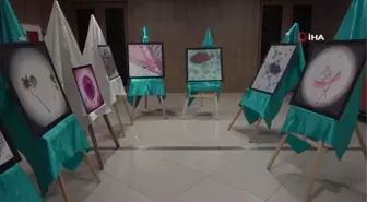 Hastalıklı dokular sanat eserine dönüştü