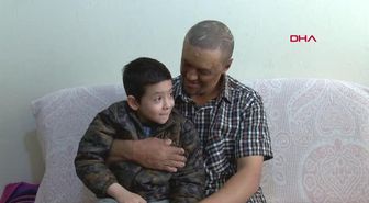 MAHSUR KALDIĞI YANGINDA YÜZÜ VE KAFA DERİSİ YANAN SERHAT DIŞLANIYORUM, ÇOCUKLAR BİLE KORKUYOR