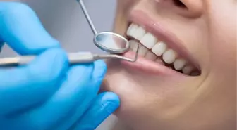 Diş Sararmasının Sebepleri ve Çözüm Yolları