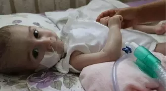 Sma hastalığı neden olur? Sma hastalığı nedir? Sma hastalığı tedavisi var mı?