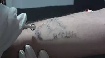 Uzmanından lazer epilasyon uyarısı: 'Yüz bölgesine yapılan lazer epilasyonlarında yüzde 90 sonuç alınamıyor'