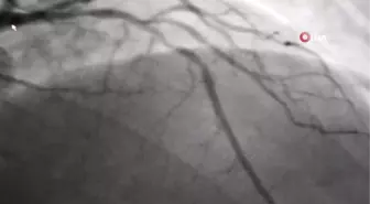 Uzmanlar, Kurban Bayramı için beslenme önerilerinde bulundu