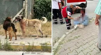 İstanbul'da köpek saldırısına uğrayan kadın gözünü kaybetti