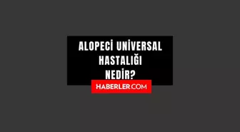 Alopeci Universal hastalığı nedir? Alopecia Universalis hastalığı belirtileri nedir? Alopeci Universal hastalığı neden olur, tedavisi var mı?