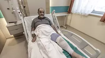 Erzurum'da İsırgan Otu Tedavisi Yanlışlıkla Yanık Oluşturdu