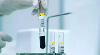 Akdeniz Anemisi: Nedir, bulaşıcı mıdır, tedavisi var mıdır?