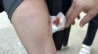 Sakarya'da Köpek Saldırısına Uğrayan Kız Çocuğu Okula Gitmeye Korkuyor