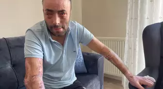 Bartın'da Maden Patlaması: Yaralı İşçilerin Acısı Sürüyor