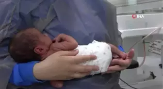 Prematüre bebekler yaşam mücadelesini Özel Ümit Hastanesinde kazanıyor
