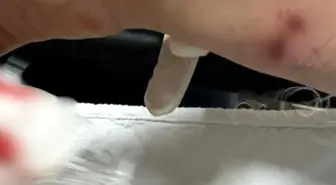 Rize'de başıboş sokak köpeği 12 yaşındaki çocuğa saldırdı