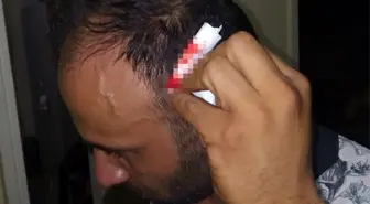 Kartal'da Kiracı, Ev Sahibinin Oğlu Tarafından Saldırıya Uğradı