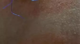 Tartışan çifte müdahale edince bıçaklandı: Kimseye yardım edemiyorum