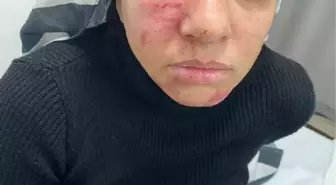 Bağcılar'da Şiddet Mağduru Kadın Yardım Bekliyor