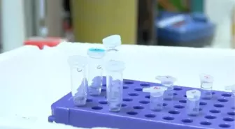 Ankara Üniversitesi Kök Hücre Enstitüsü, SMA Hastalığı için Kişiye Özel İlaç Test Kitini Geliştiriyor