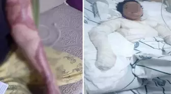 Eşi ve kayınbiraderi bacağına ütü basıp, kolonyayla yakmaya çalıştı