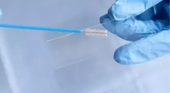 Smear testi nedir? Smear testi ne için yapılır?