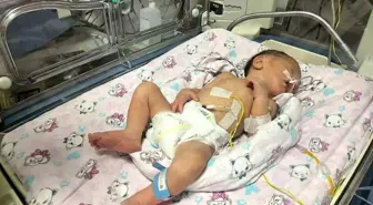 Adana'da trafik kazasında hayatını kaybeden annenin karnından sezaryenle alınan bebek hayati tehlikeyi atlattı
