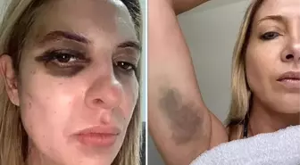 Eski devlet başkanı, karısını hastanelik etti