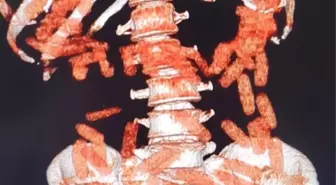 Kayseri'de Uyuşturucu Operasyonu: İki Şüpheli Yakalandı