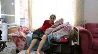 Kemik Erimesiyle Boğuşan Özlem Arat, 37 Ameliyatın Ardından Yatağa Mahkum Yaşıyor