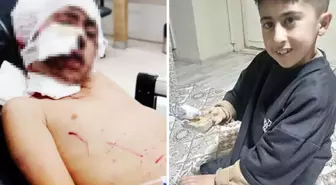 Başıboş köpekler bakkala giden 10 yaşındaki çocuğu parçaladı