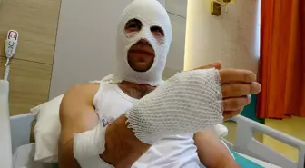 Nişanlısına hediye hazırlarken sprey boya kutusu bomba gibi patladı