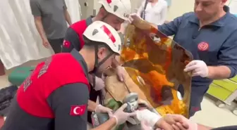 Şanlıurfa'da İşçinin Koluna Demir Şiş Saplandı