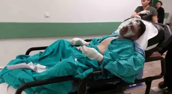 Samsun'da Tinerle Yanan Genç Ağır Yaralandı