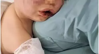 Aile ve Sosyal Hizmetler Bakanlığı'ndan 2 Yaşındaki Çocuğa Devlet Koruması