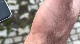 Kars'ta Bahar ile Keneler Yeniden Ortaya Çıktı