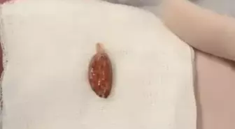 16 Günlük Bebek Badem Şekerine Takıldı