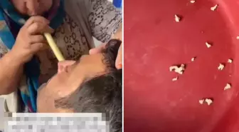 Hindistan değil Adana! Bu saçmalığa inanıp tedavi için gidenler var