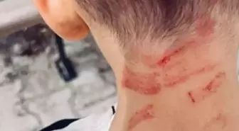 Burdur'da Özel Gereksinimli Çocuğa Darp İddiası: Soruşturma Başlatıldı