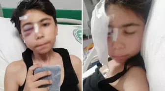 Oyun oynarken sabitlenmeyen kale direği başına düştü, çift görmeye başladı