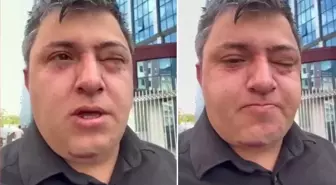 Vahim iddia: Altındağ Belediye Başkanı Tiryaki belediye işçisini darp etti