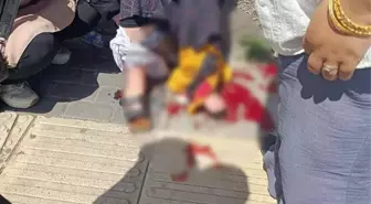 Keçiören'de Silahlı Kavga: Masum Geçici Yaralandı