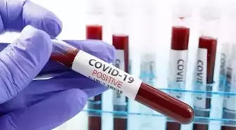 ABD'de Covid-19 Sebebiyle Haftada 300'den Fazla Ölüm