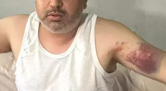 Adana'da Dayısı Tarafından Beyzbol Sopasıyla Darbedilen Kişi Yaralandı