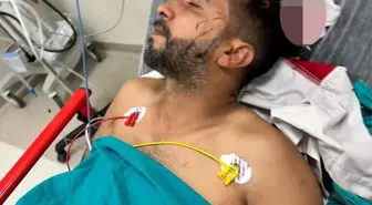 Adana'da Döner Ustasına Yorgun Mermi İsabet Etti