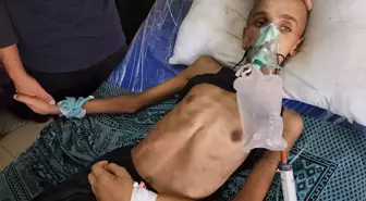 Gazze'de İnsani Durum Çığır Açıyor: 16 Yaşındaki Muhenned'in Dramatik Hikayesi