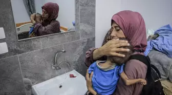 Gazze Şeridi'nde 'açlığın' sembolü haline gelen Filistinli bebeğin doktoru İsrail'in iddialarını yalanladı