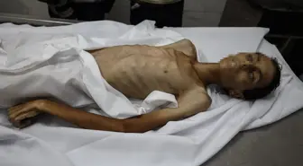 Gazze'de Açlık Politikası: 17 Yaşındaki Filistinli Çocuk Hayatını Kaybetti