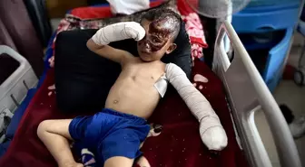 Gazze'de Saldırılarda Yetim Kalan 4 Yaşındaki Ahmed'in Acı Hikayesi