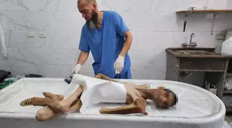 Gazze'de Açlık Sebebiyle Bir Kişi Daha Hayatını Kaybetti