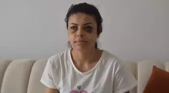 Düğün Kavgasında Kadına Tüfekten Saçma Isabet Etti
