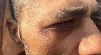 Taksim'de 'Borcunu sileceğiz' yalanıyla alıkonulup darbedildi: 'Şikayetini çek aileni öldürürüz' tehdidi