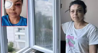 Pencereden düğünü seyrederken gözünden vuruldu: Hayatım bitti