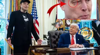Elon Musk'ın gözüne ne oldu? Basın toplantısının önüne geçen fotoğraf