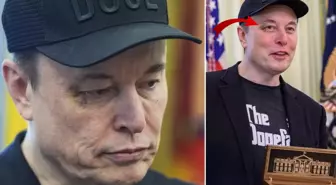 Elon Musk'ın gözündeki morlukla ilgili bomba iddia